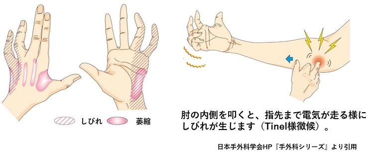 0-tl-bui1q08b5xuc8c560ne46ecndnn.jpg