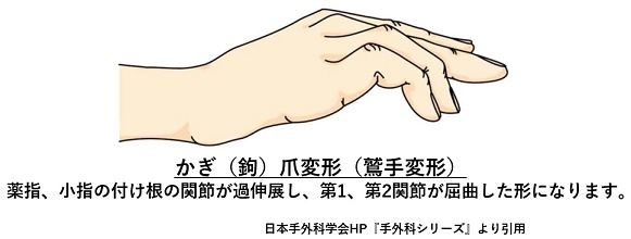vm7uz_32qqhdxrsru1qr9osc3wceokm1.jpg