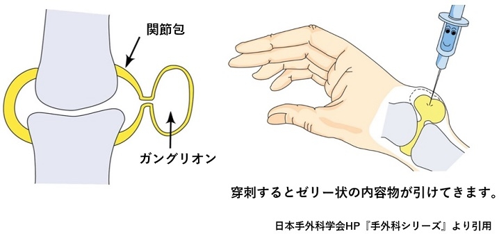 n0_-z9azu42hu0otp7191v1jv0s0air0.jpg
