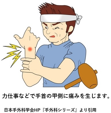 _1lkl2f42u0qmd65uhlu-4vm53rhntj8.jpg _1lkl2f42u0qmd65uhlu-4vm53rhntj8.jpg