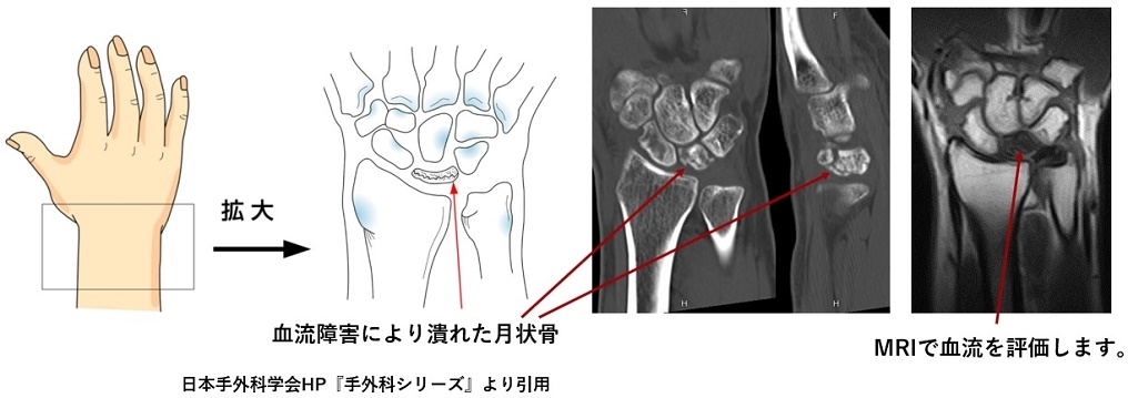 jnhlzzgmcpuumkv911urp574rr9c0_t0.jpg jnhlzzgmcpuumkv911urp574rr9c0_t0.jpg