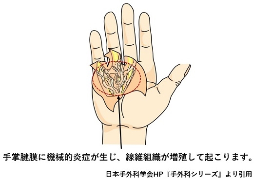 tp7ronwk0wtom9kdrwh708qqpy09e3bb.jpg