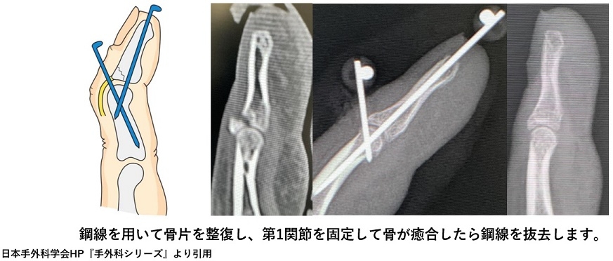 ufwxs8re8f-u8xfy7jpz3eqksp9kmge2.jpg ufwxs8re8f-u8xfy7jpz3eqksp9kmge2.jpg