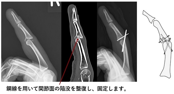 luhu695n4qzhu_k92_qp78dya81o7yh1.jpg luhu695n4qzhu_k92_qp78dya81o7yh1.jpg