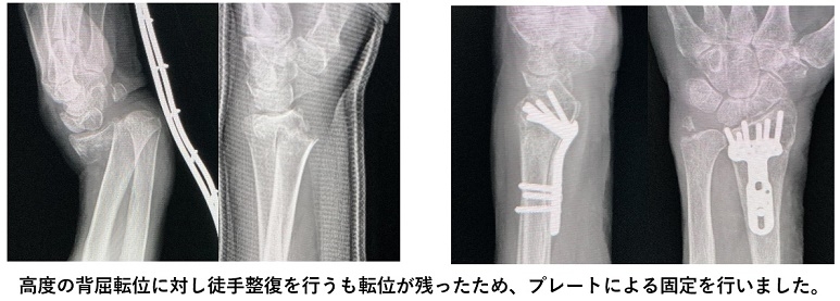 kpjhrrcua2hf8czhmv-ap6qyzjifx-76.jpg kpjhrrcua2hf8czhmv-ap6qyzjifx-76.jpg