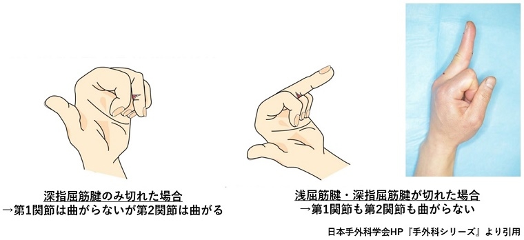 z9ch1ffktqbp8bs0iyuj2ikt4ncwjnty.jpg z9ch1ffktqbp8bs0iyuj2ikt4ncwjnty.jpg