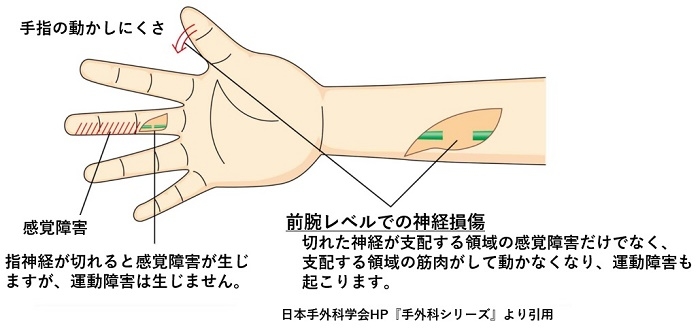 __78jyh9xkyh-k8_66inwrn97y3yq_xs.jpg __78jyh9xkyh-k8_66inwrn97y3yq_xs.jpg
