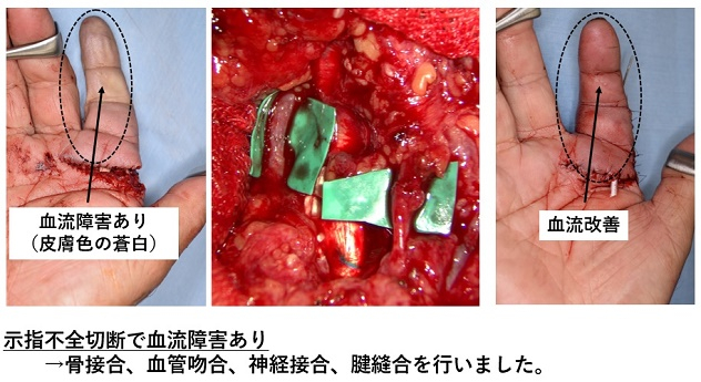 4_sqf__lox4i6o6ylx2yl9jqb575411g.jpg 4_sqf__lox4i6o6ylx2yl9jqb575411g.jpg