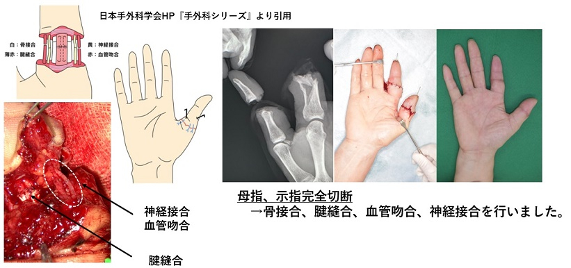qzi7iapcw51rndzomw-5wq74ki4_2t8f.jpg qzi7iapcw51rndzomw-5wq74ki4_2t8f.jpg