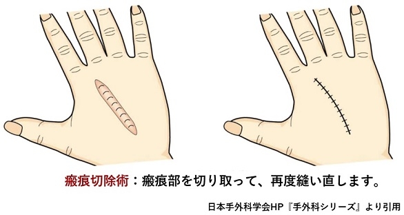 lnxdqv64ccy6464253dilsobyuiye_rl.jpg