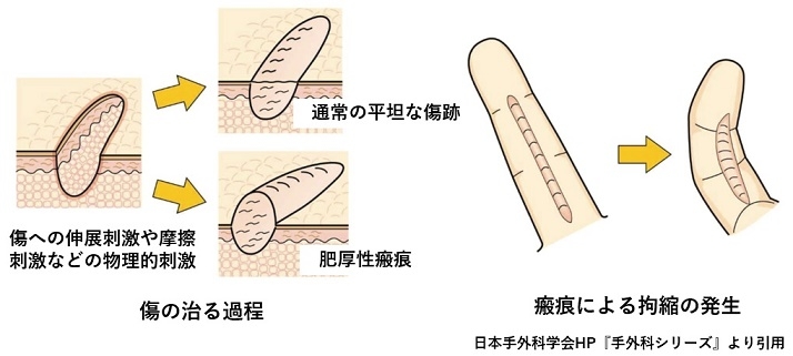 wd6s7wxi-3jv9cm_l45khll-j3mr2ryz.jpg